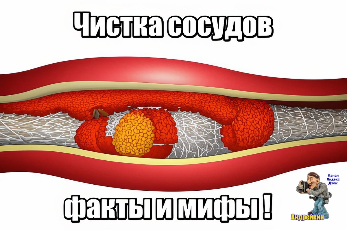 Не так давно у меня началась стенокардия, а, как известно, появляется она так сказать благодаря тому, что сосуды имеют отложения на стенках в виде холестериновых бляшек и само собой меня заинтересовал