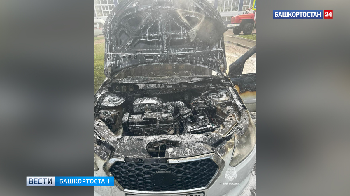    Машина сгорела за 5 минут: в Башкирии молодой водитель получил ожоги 44% тела