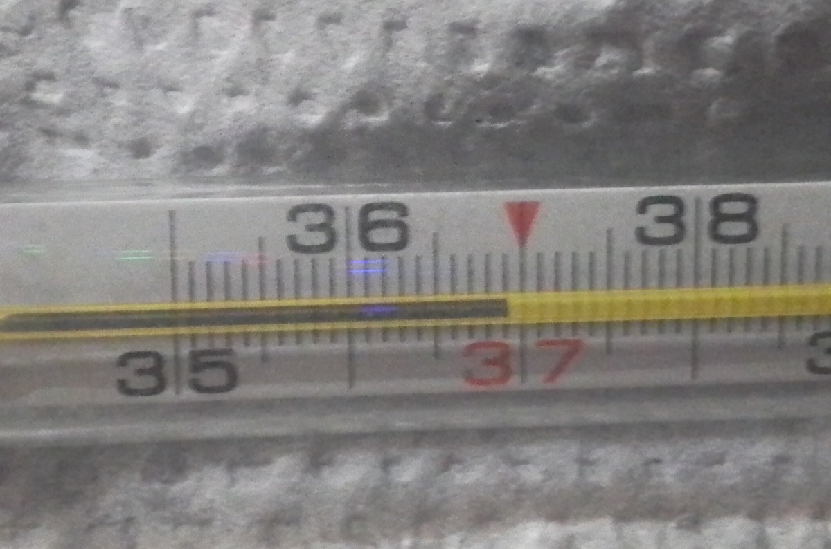 Укус гадюки - температура в первый день