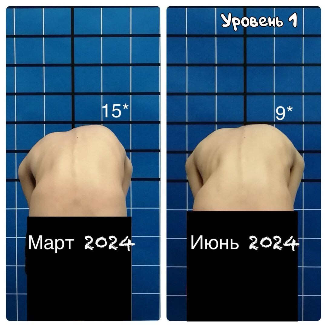 Динамика на фоне консервативной терапии