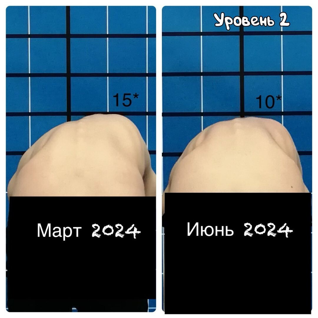 -2-2