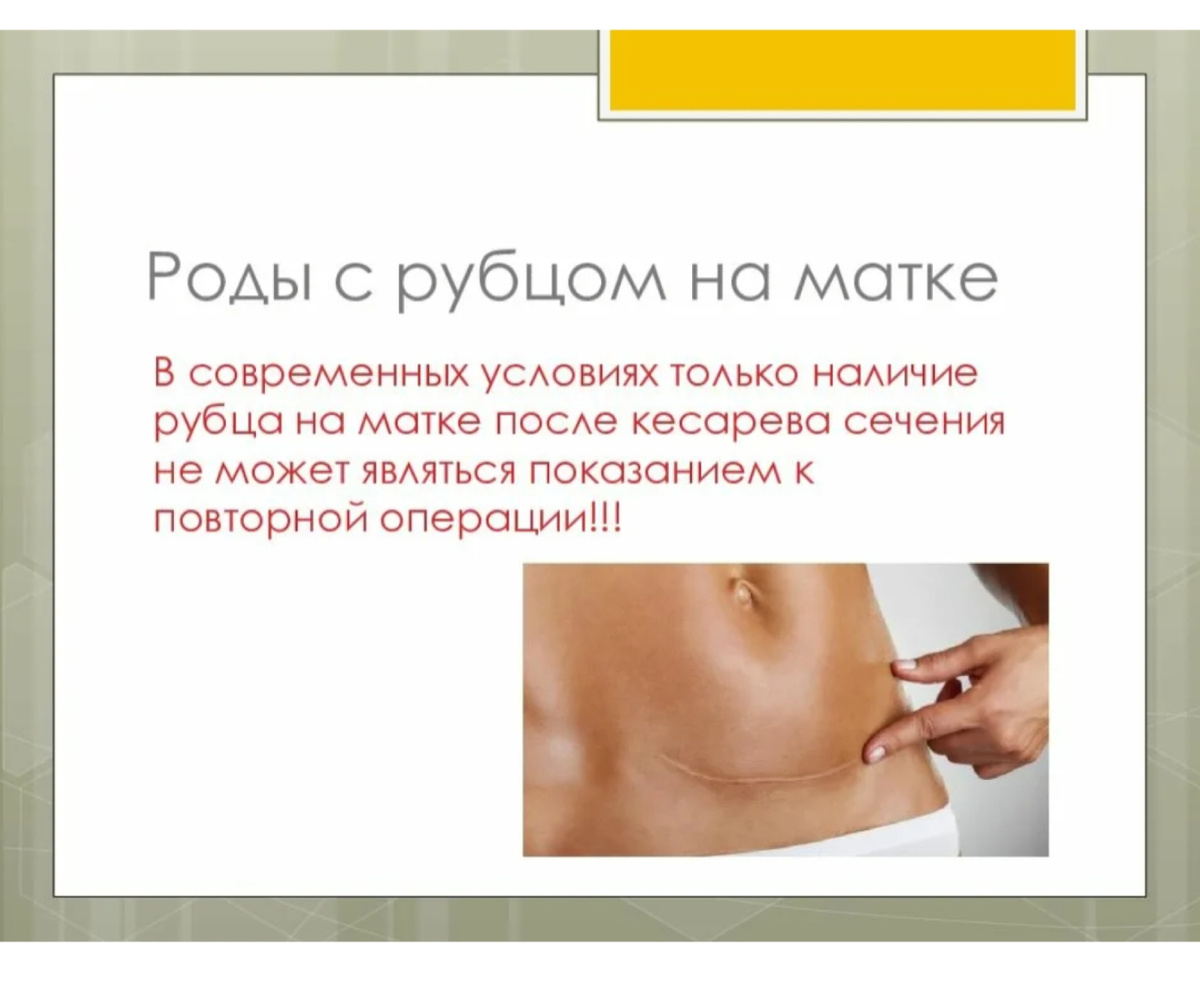 Рубец после кесарева сечения узи. Ведение после кесарево сечение. Что такое рубец на матке после кесарева. Ведение родов с рубцом на матке. Нормальная толщина рубца на матке.