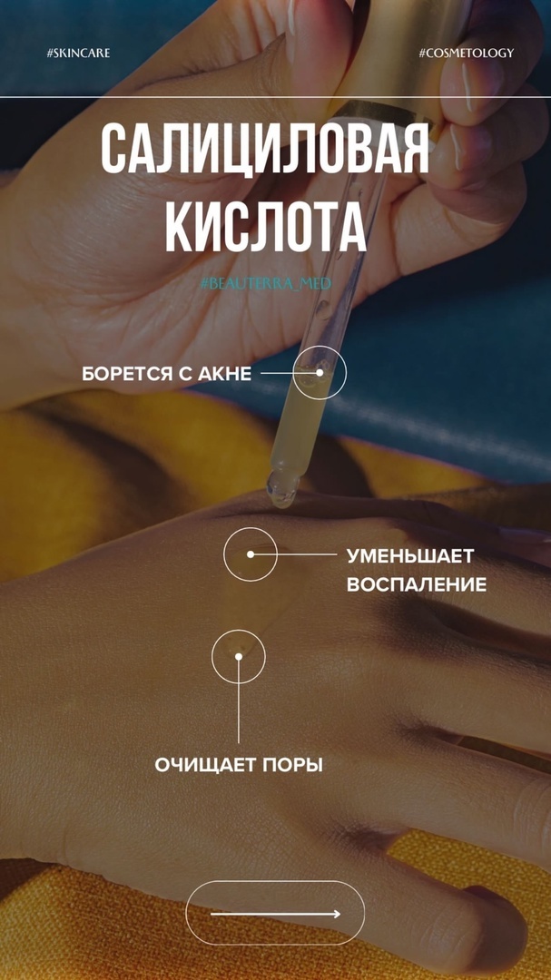 Что делает салициловая кислота? Разбираем компоненты вместе с косметологами косметологической клиники BEAUTERRA