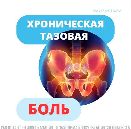 Синдром хронической тазовой боли