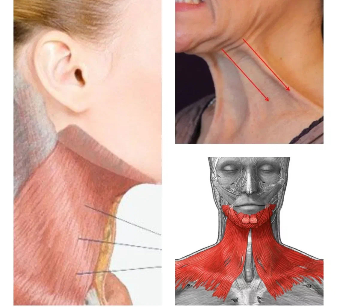 Артерии шеи nel 2024 Arteria carotide, Anatomia, Massaggio