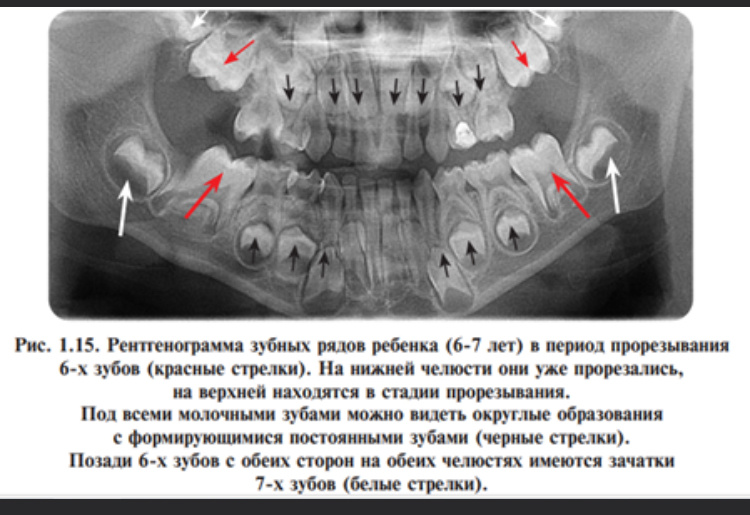 Многоэтажные зубы