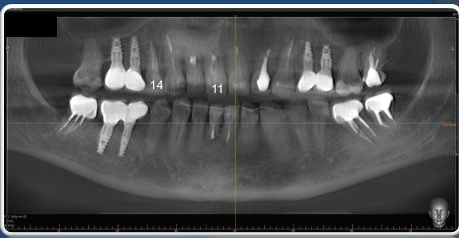 Картина по результатам компьютерной томографии на момент обращения.