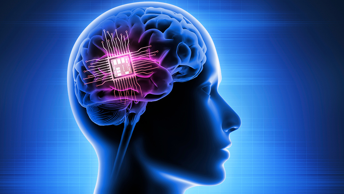 Британский подросток с тяжелой формой эпилепсии стал первым в мире пациентом, на котором испытали нейростимулятор для контроля приступов, вживленный в мозг.