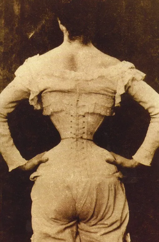   Диета с ленточными червями. Чтобы быть красивой в викторианскую эпоху, нужно было быть очень, очень худой.
