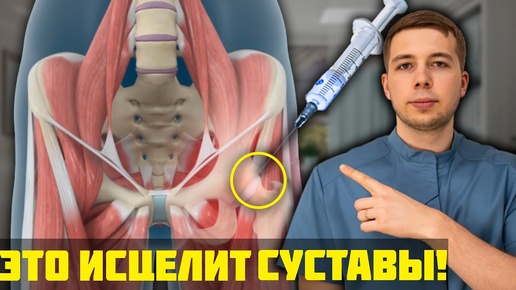 Video herunterladen: 5 ЛУЧШИХ способов вылечить суставы БЕЗ ОПЕРАЦИИ! Это ТОЧНО тебе поможет!