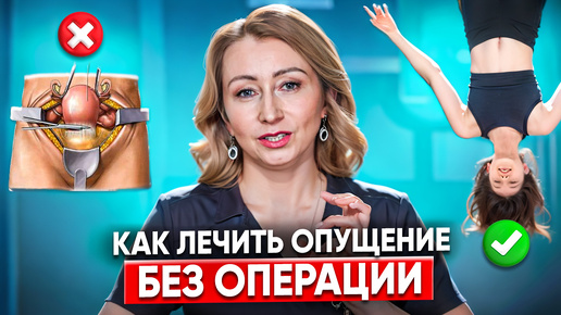 Download Video: Опущение матки. Причины. Чем грозит опущение или выпадение матки и что делать? Как лечить опущение?