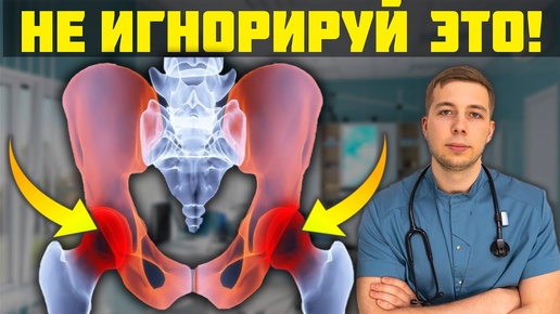 Download Video: Болит ТАЗОБЕДРЕННЫЙ СУСТАВ? Никогда не игнорируйте ЭТИ УПРАЖНЕНИЯ!