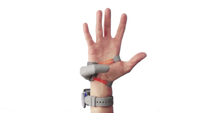 В современном мире роботизированные протезы позволяют людям с различными травмами конечностей вернуть себе полностью или частично утраченную функциональность, что ещё совсем недавно казалось чем-то из-8