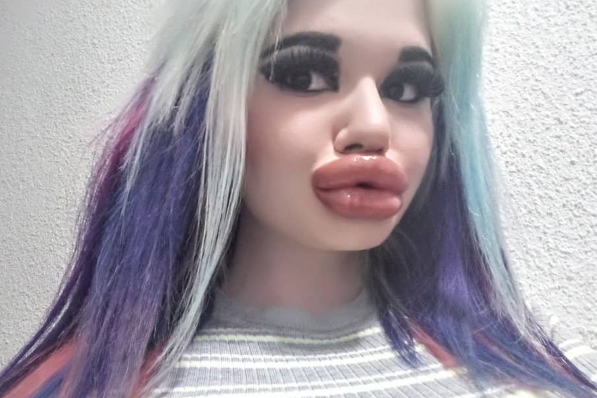 Чемпионка мира по размеру губ болгарка А. Иванова