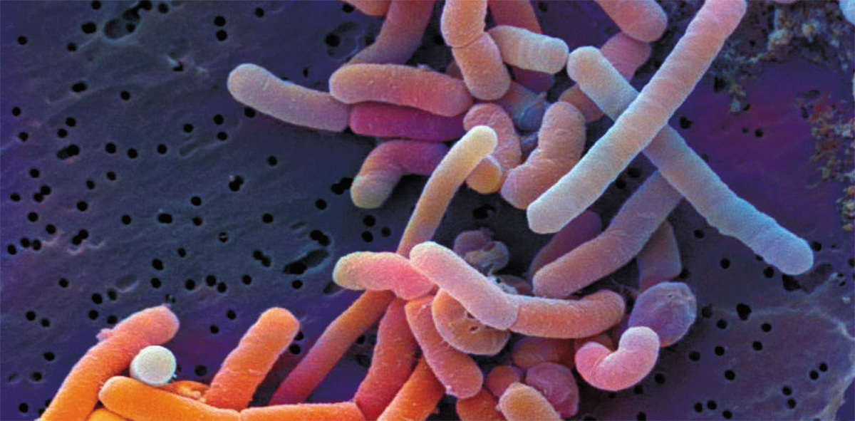Молочнокислая бактерия Lactobacillus paracasei, способная выживать при высокой кислотности среды, является частью нормальной кишечной микрофлоры и проявляет свойства пробиотика. © CC BY-SA 3.0 de/ Dr. Horst Neve, Max Rubner-Institut 