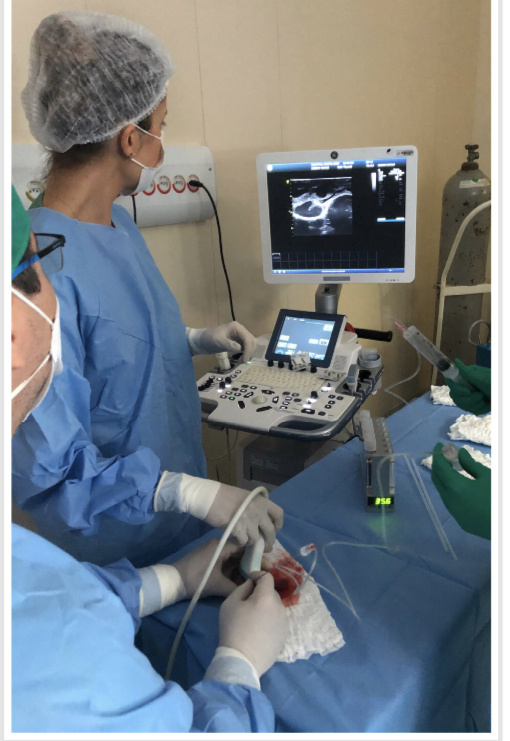 Набор для извлечения ооцитов ex vivo в операционной, где яичники были помещены на стерильную хирургическую ткань, при комнатной температуре, а фолликулярная аспирация под ультразвуковым контролем выполнялась с помощью стандартной аспирационной однопросветной иглы в закрытой системе, подключенной непосредственно к пробирки, которые помещали в трубчатый подогреватель, предварительно нагретый до 35,6°С.