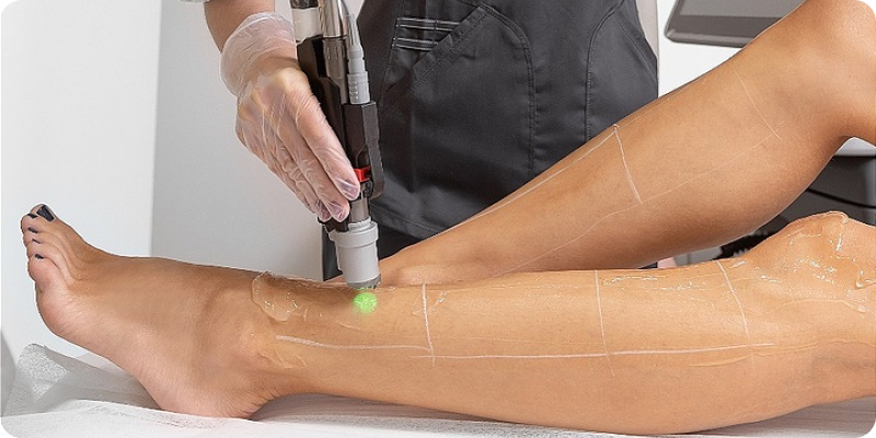 Эпиляция для всех фототипов волос