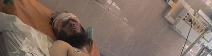 Получил тяжёлое ранение и был несколько дней в коме, в реанимации.