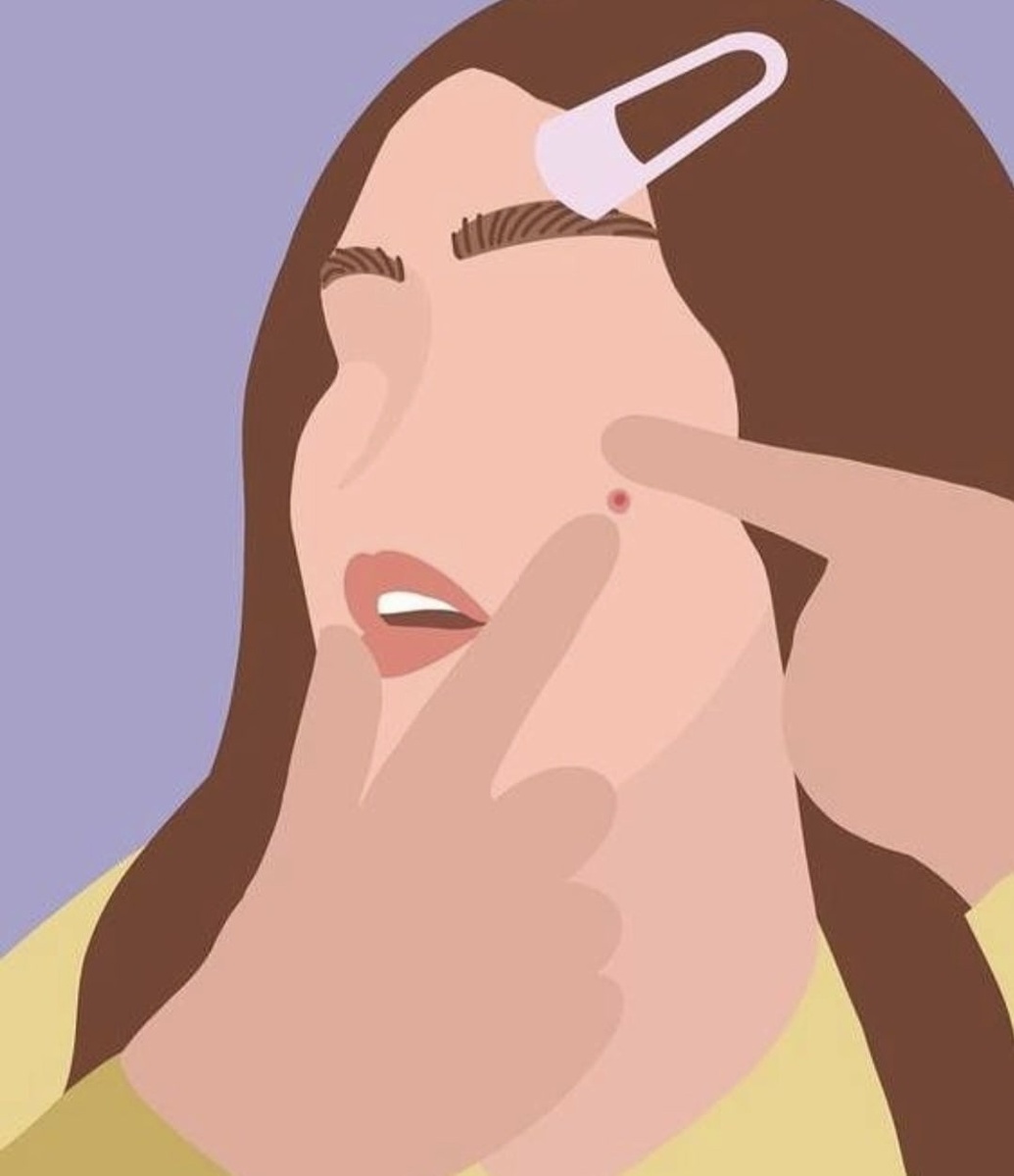 Правильно боремся с прыщами