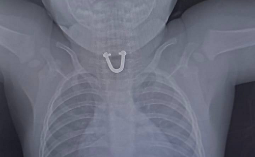    Фото: t.me/gorbolnica1nvrsk