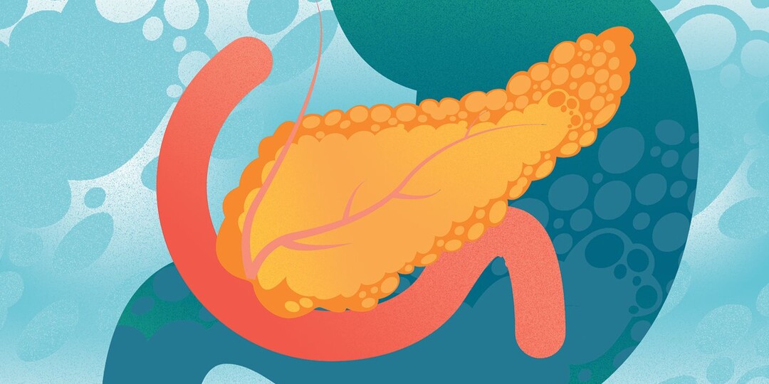 Как избежать хронического панкреатита?