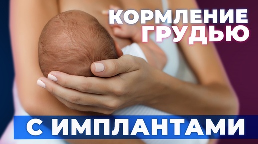 Кормление грудью после маммопластики | Кормление грудью с имплантами