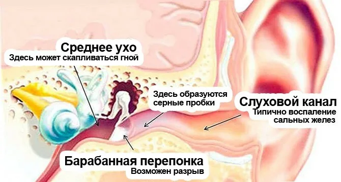 Стреляет в ухе: что нужно знать и делать в домашних условиях