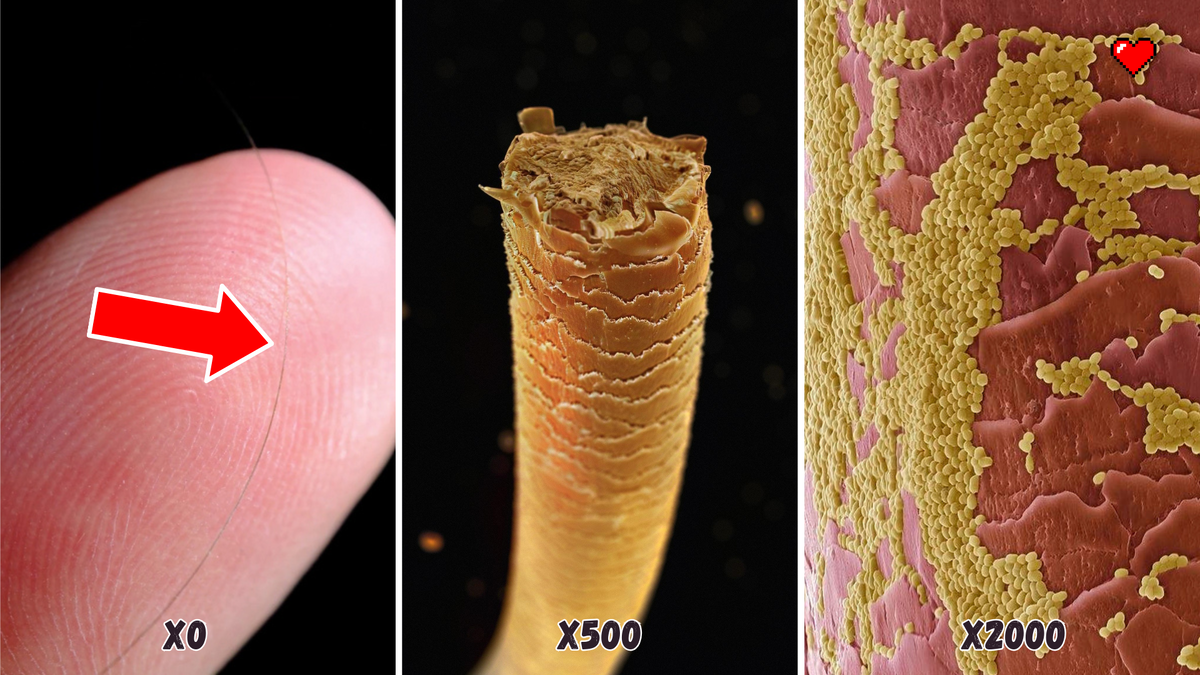 Бактерии на поверхности человеческого волоса. Сканирующий электронный микроскоп