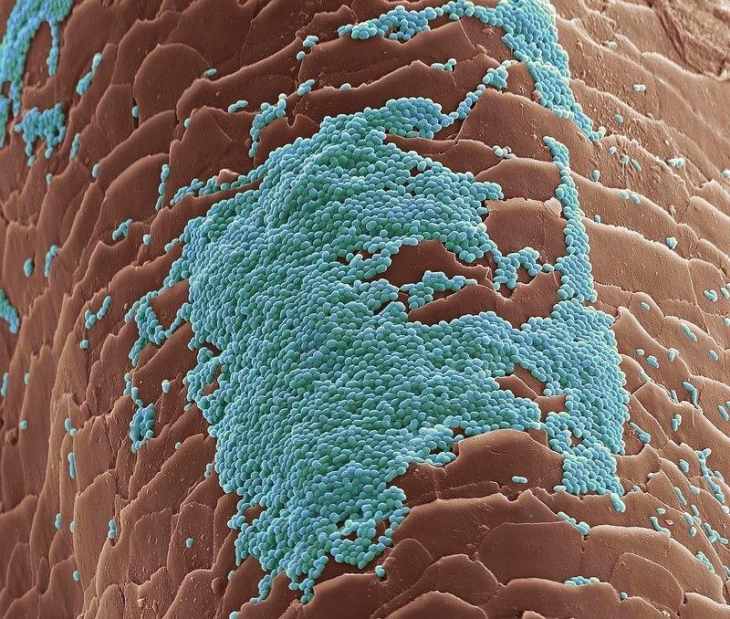 Колонии бактерий на поверхности волоса. Сканирующий электронный микроскоп.