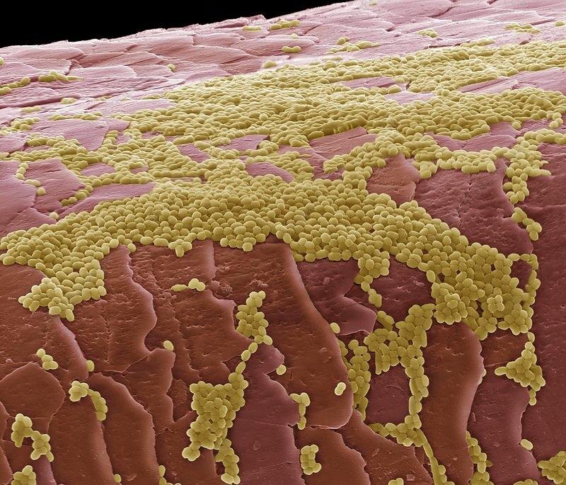 На коже и волосах человека учёные обнаружили более тысячи видов бактерий. Эта микрофлора обычно не патогенна, а виды, которые её составляют, не вредят человеку, а порой даже приносят пользу.-2-2