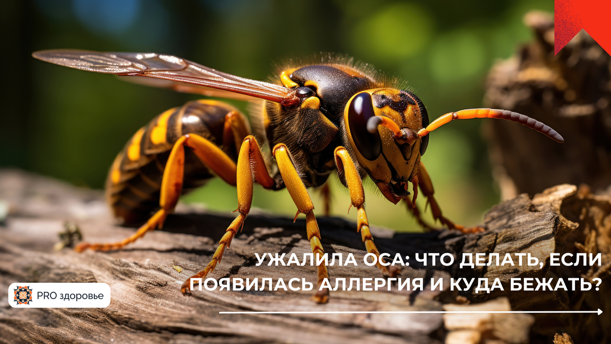 что делать при укусе осы