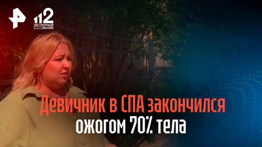 До свадьбы не заживет: девичник в СПА закончился ожогом 70% тела для двух девушек в Санкт-Петербурге