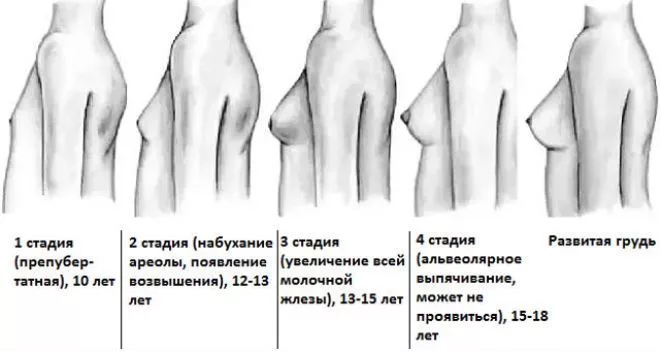 Центр Профессиональной Медицины - Плотная грудь: что вам нужно знать?