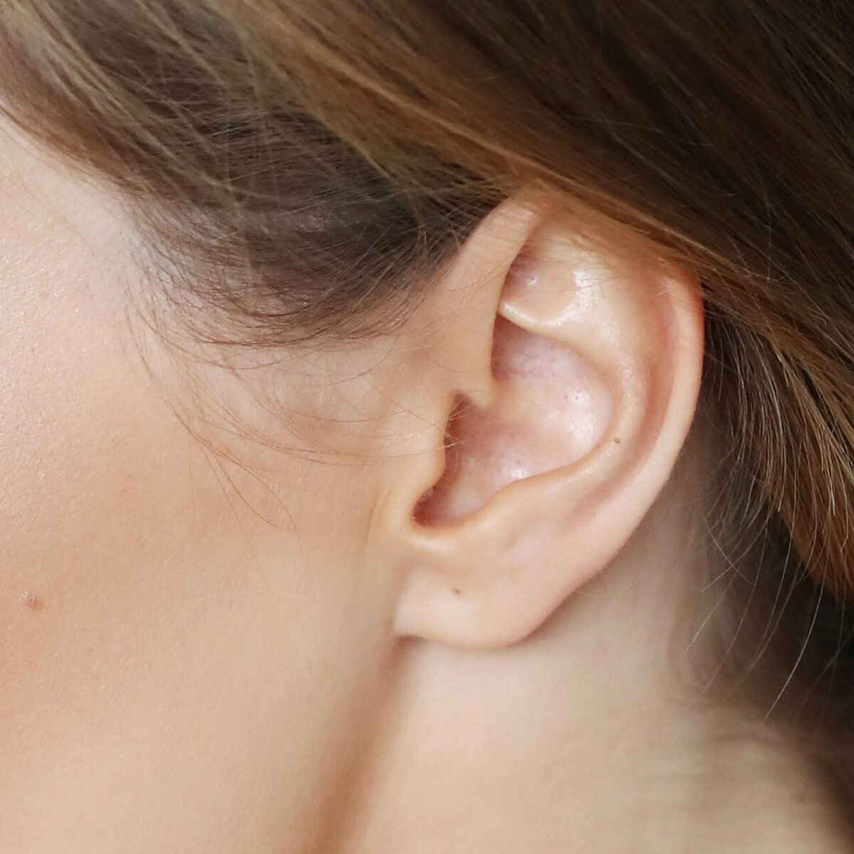 Ухо похоже на сложный архитектурный проект: в нём множество «коридоров» и «залов», по которым передвигаются звуковые волны, как гости на приёме. А структура уха уникальна, как отпечатки пальцев. Трудно встретить двух людей, даже родственников, с похожими ушными раковинами.
Нижняя и верхняя ножка противозавитка, ладьевидная и треугольная ямка, противозавиток и завиток, противокозелок и козелок, хвост и ножка завитка, передняя связка и межкозелковая вырезка – это не набор случайных слов, а важные части нашего уха. Они работают в едином ансамбле, помогая звуковым волнам проникать в ушной канал и защищая от воды.
Ушной хрящ плотно прикреплён к голове, однако его мышцы у человека развиты слабо, поэтому нам сложно двигать ушами, как это делают животные.
Кровь и нервы активно снабжают ухо, обеспечивая его здоровье и чувствительность. Нервные волокна, приходящие к ушам от лицевого, большого ушного и ушно-височного нервов, поддерживают чувствительную и двигательную функцию.
С таким сложным «архитектурным проектом» сможет разобраться только квалифицированный специалист, поэтому при любых подозрениях на проблемы со слухом, не медлите, запишитесь к нам на приём на сайте: mastersluh.ru. Наши сурдологи, как настоящие архитекторы уха, проведут детальное обследование и определят схему лечения.