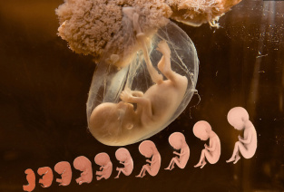 ФОТО EVACLINIC IVF