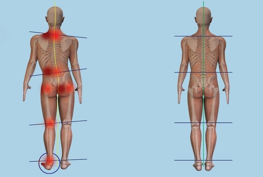 Источник: Яндекс. Картинки. Положение тела при ассиметрии и симметрии.
