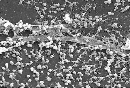 Иллюстрация: Pixnio