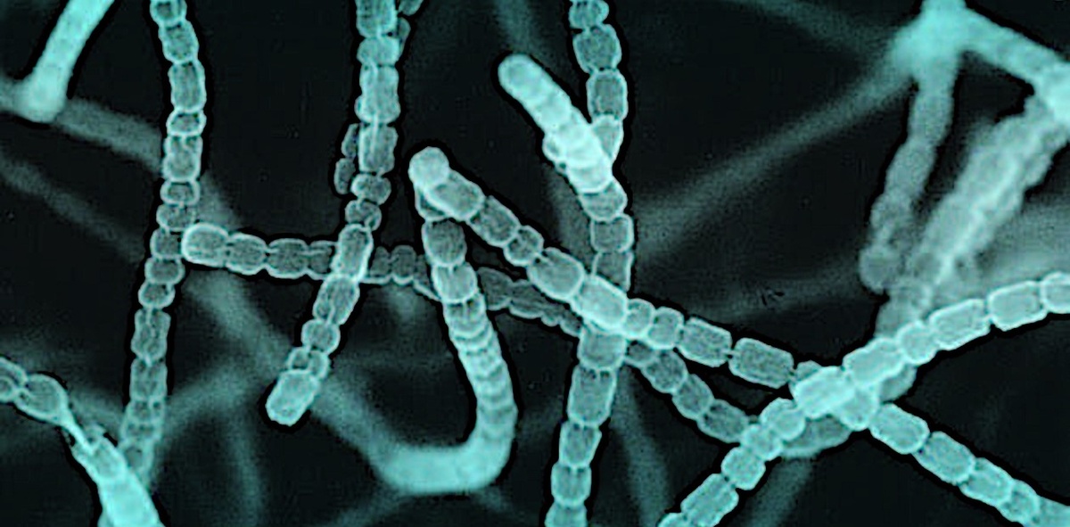 Streptomyces griseus. Сканирующая электронная микроскопия