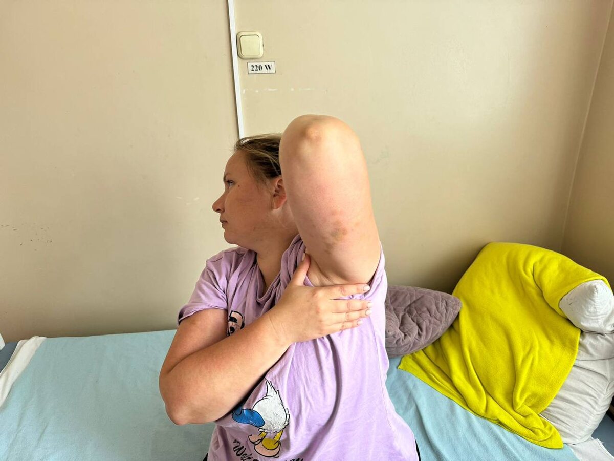 Синяки и гипертонический криз - результаты встречи с руководством. Фото "Русская Община ZOV"