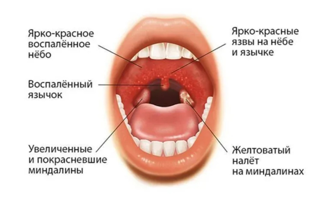 Нестыдный вопрос: опасен ли оральный секс для здоровья полости рта?