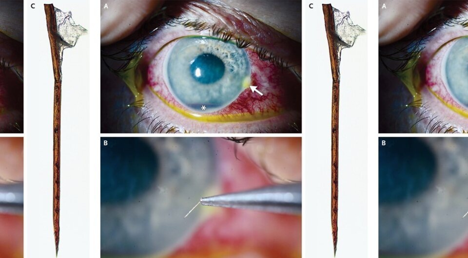   Talia N. Shoshany and Zeba A. Syed / The New England Journal of Medicine, 2024