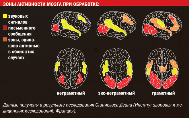 Проблемы мозговой деятельности. Активность мозга. Зоны активности мозга. Мозг во время чтения. Активность мозга при чтении