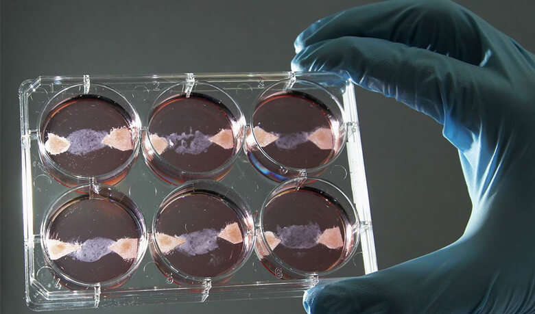 Образцы мяса in vitro, выращенного в лаборатории Университета Маастрихта Фото: Франсуа Ленуар / Reuters/REUTERS