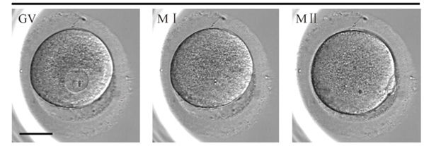 GV - незрелый ооцит; M I - незрелый ооцит на стадии метафазы 1-го деления мейоза; M II - зрелый ооцит.