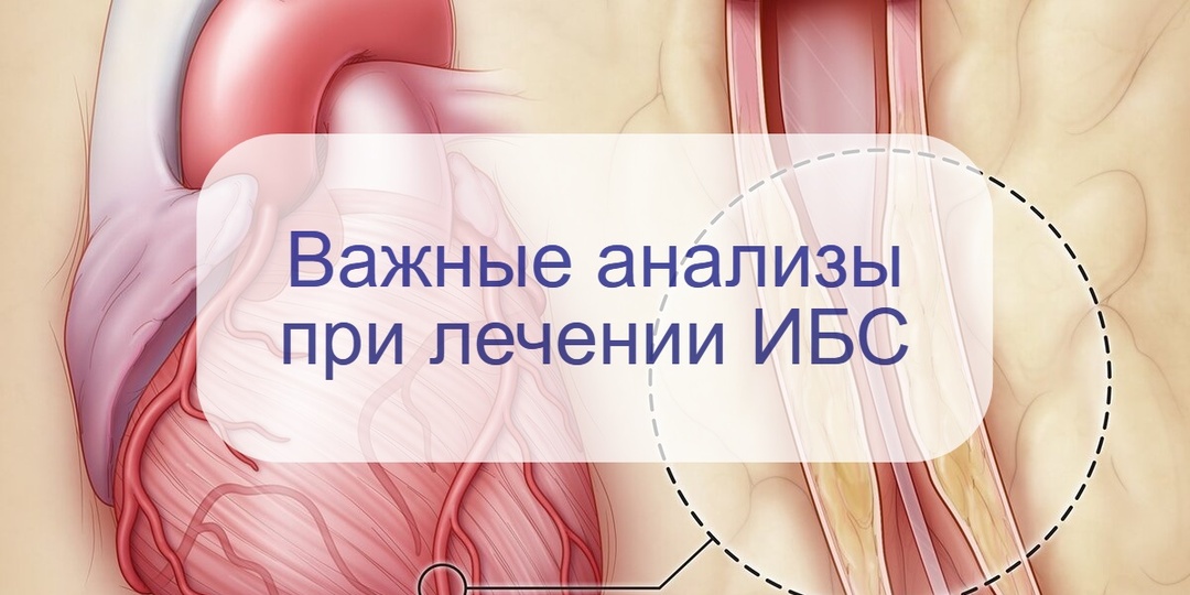 У вас ИБС? Вот какие анализы надо сдавать, чтобы контролировать болезнь