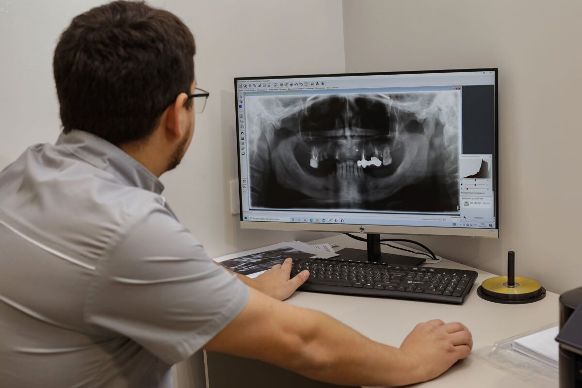 Обработка результатов компьютерной томографии в клинике «Мир Улыбок». 