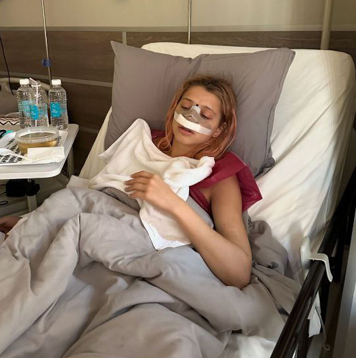    Юлия Гаврилина сделала повторную ринопластикуСоцсети Юлии Гаврилиной