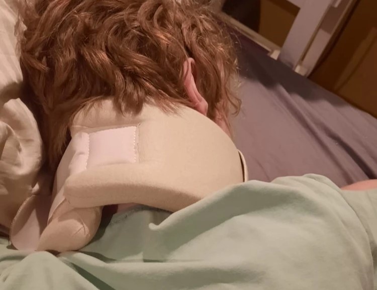 Мальчик ходит в воротнике Шанца. Фото: предоставлено мамой ребенка, nsk.kp.ru.