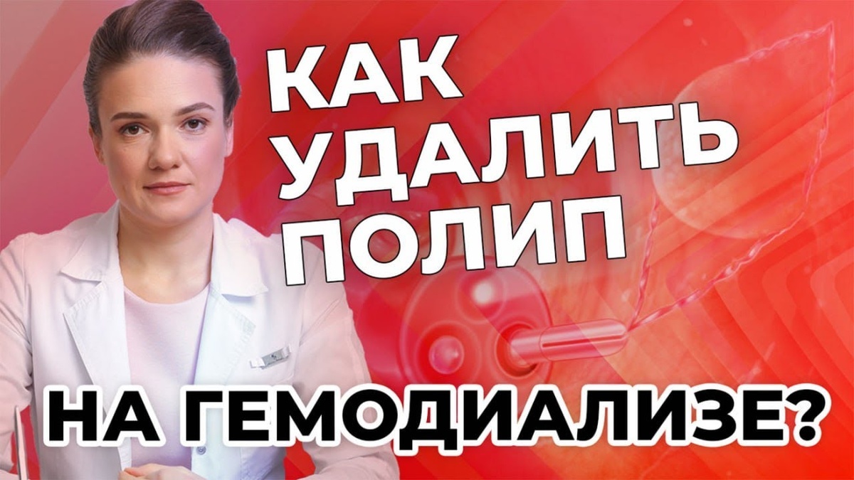 "Делала колоноскопию 2 года назад. Было обнаружено 8 полипов. Врач  сказал: "Трогать не будем, потому что вы на гемодиализе". Что мне делать  дальше?"  Отвечаю на вопрос подписчицы в новом видео.