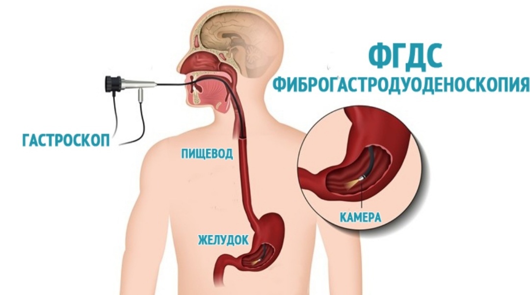 Картинка из открытого источника